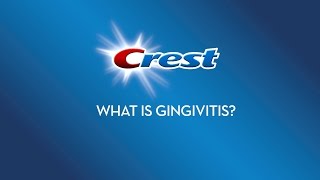 What is Gingivitis? Explained by Crest