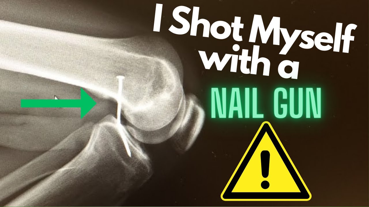I Shot Myself With A Nail Gun! Why Safety is So Important.