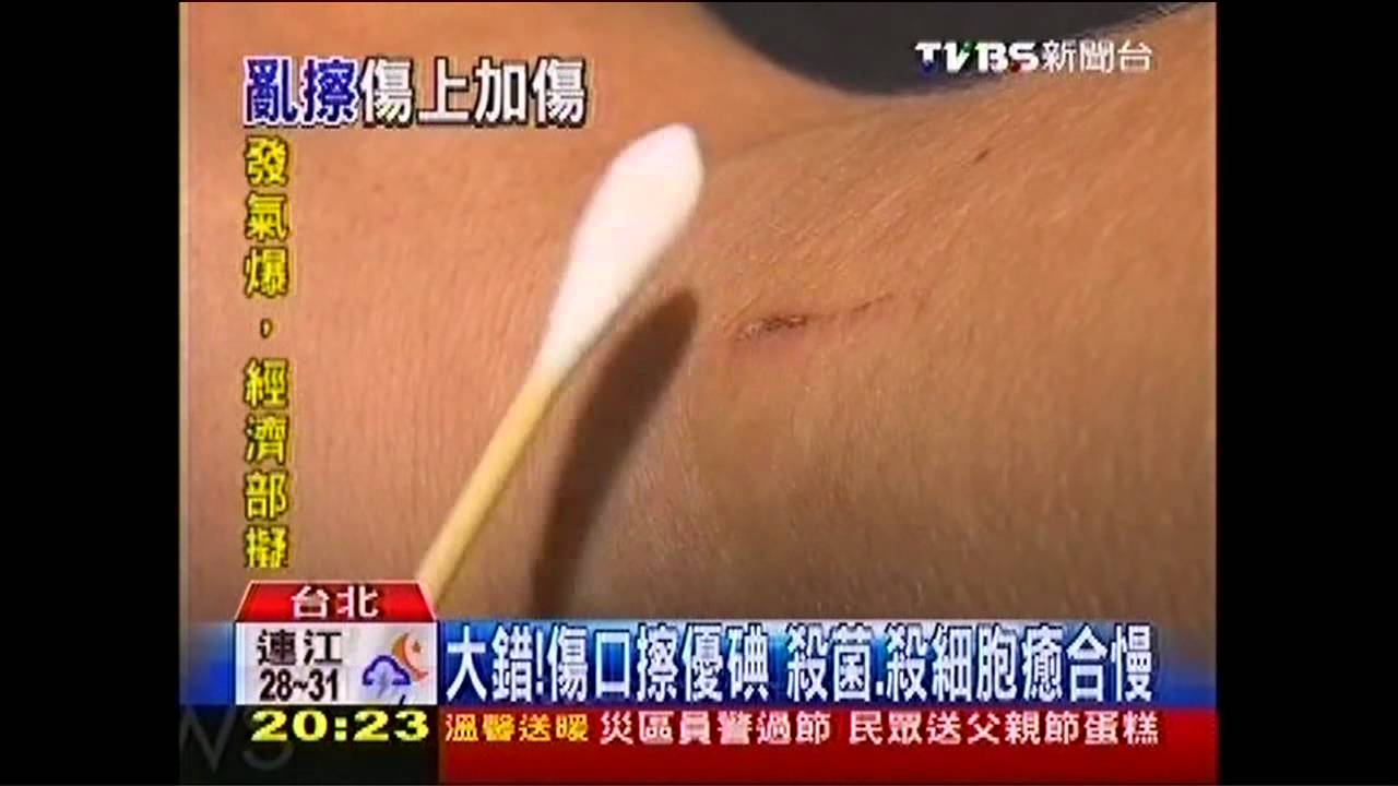 大錯！傷口擦優碘　殺菌、殺細胞癒合慢