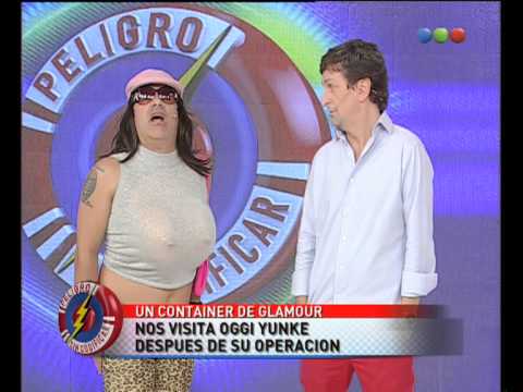 Oggi Yunque muestra su nuevo implante - Peligro Sin Codificar