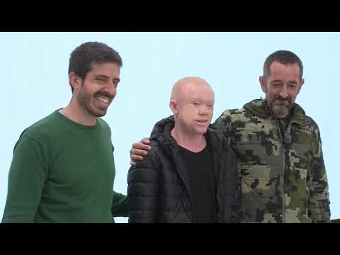 Guineano albino operado por Cavadas