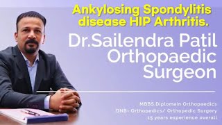 Ankylosing Spondylitis Disease HIP Arthritis Operated By Dr. Shailendra