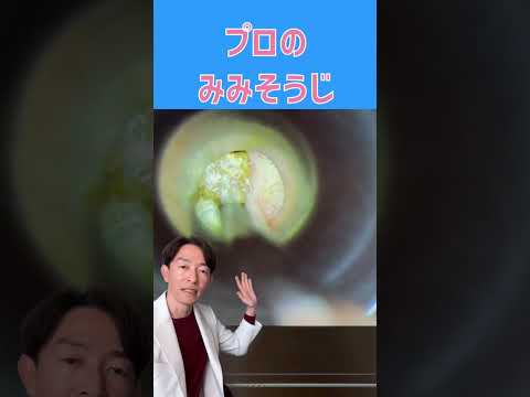 適切な耳掃除:多くの人はこれにさえ注意を払っていません