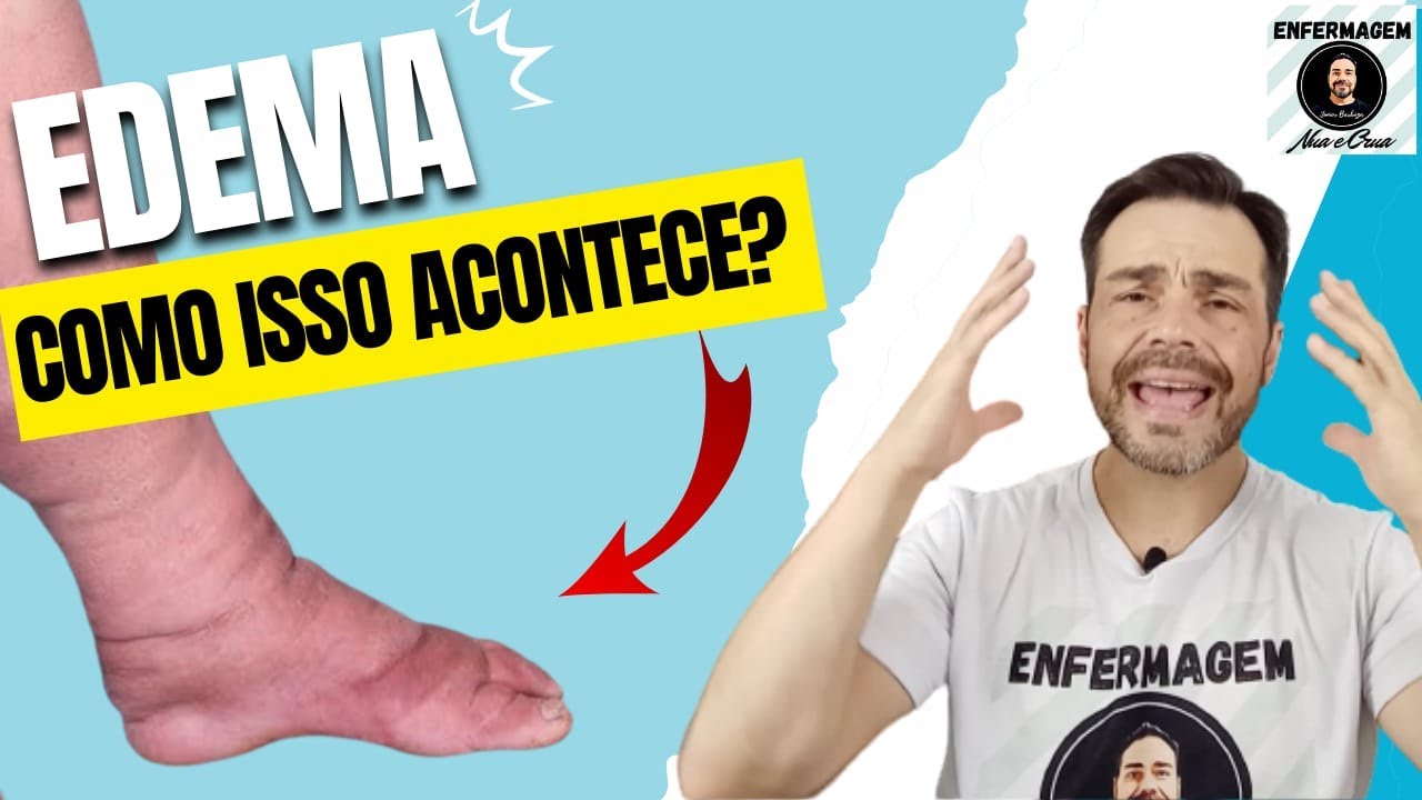 EDEMA como isso acontece? Descubra como funciona a PRESSÃO HIDROSTÁTICA E PRESSÃO COLOIDOSMÓTICA