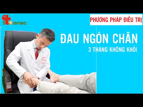 Phương pháp Điều trị Viêm khớp ngón chân | Bác sĩ Nguyễn Trọng Thuỷ