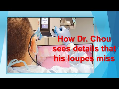 Mielscope overview video