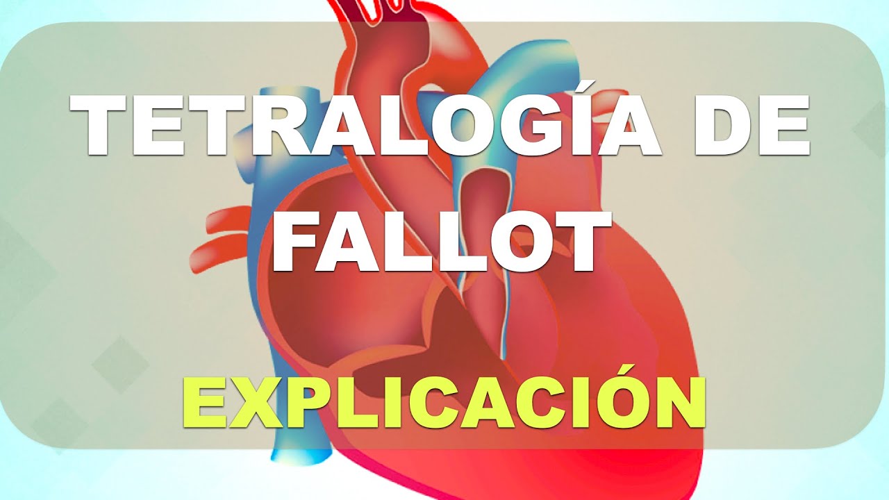 Tetralogía de Fallot. Explicación