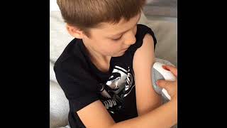 Dexcom G6 insertion by Beren age 6