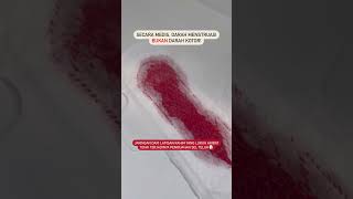 Download lagu DARAH MENSTRUASi = DARAH KOTOR?! #womenshealth #periods #facts #shorts mp3