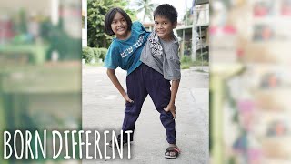 The Conjoined Twins Who Don&#39;t Want To Separate | BORN DIFFERENT