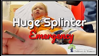 Huge Splinter Stuck in Toddler&#39;s Foot
