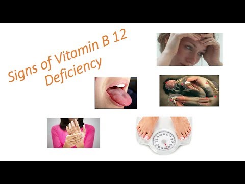 Don’t Ignore These Warning Signs Of Vitamin B12