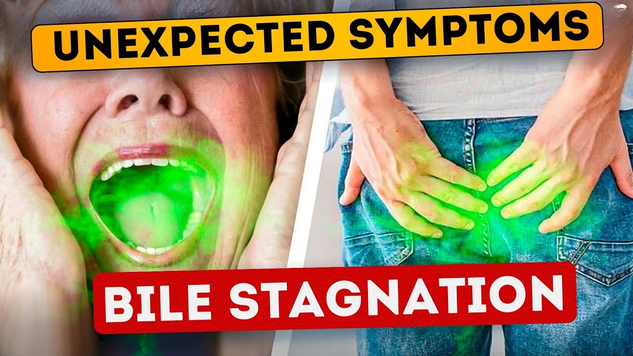 Must Know! Signs of Bile Stagnation! They Won't Tell You This in the Hospital!
