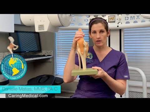 image-Can you fix hypermobility?