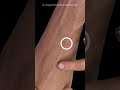 IV Insertion Nursing Tip Avoid Visible Vein Valves During IV Cannulation Iv Ivtherapy Nurse