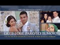 Deep Lobe Parotid Tumor Surgery for Young Mother at Osborne Head & Neck Institute