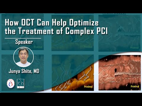 How OCT Can Help Optimize the Treatment of Complex PCI