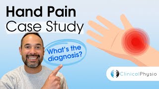 Hand Pain Case Study | Expert Physio Review including Assessment, Diagnosis and Treatment!