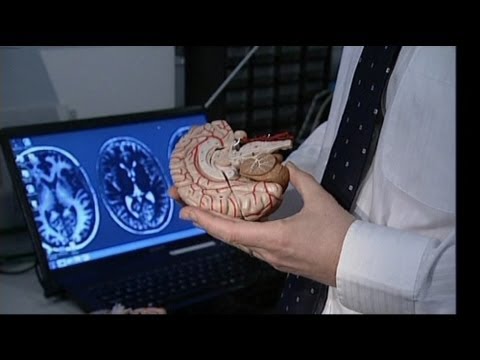 euronews science - Depression im Gehirn nachweisbar