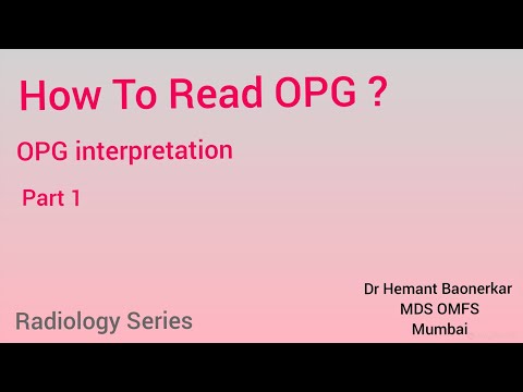 How to Read OPG ? / OPG interpretation /Radiology series Part 1/ Use of Orthopantomagram byDr Hemant