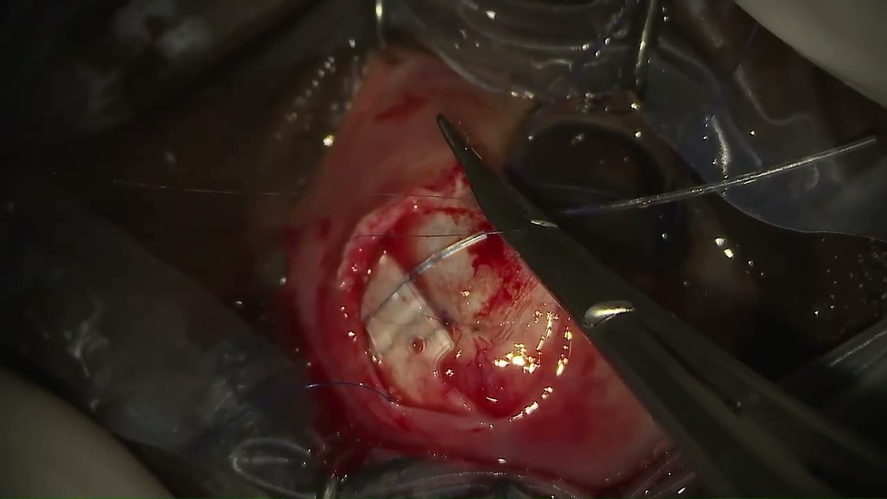 Pierfilippo Sabella-3