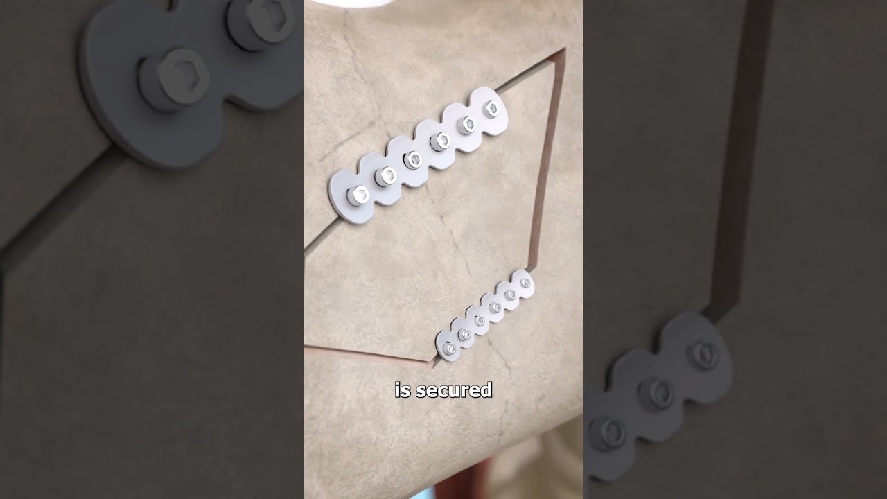 Rebuilding A Jaw With Rib Bone 😮