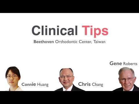 CC445. Clinical Tips: Timing, Indicators and Tips for IPR