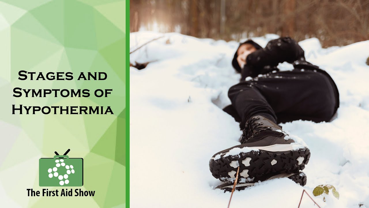 Stages and Symptoms of Hypothermia