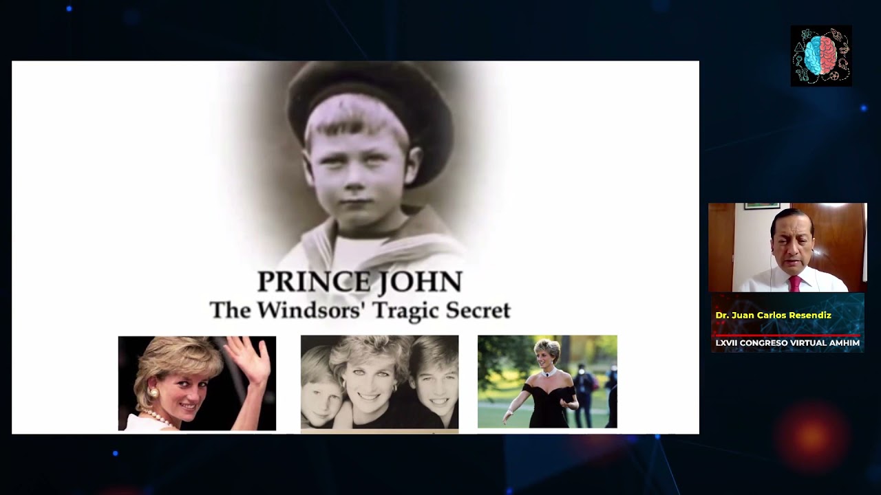 Epilepsia en niños Porqué Valproato