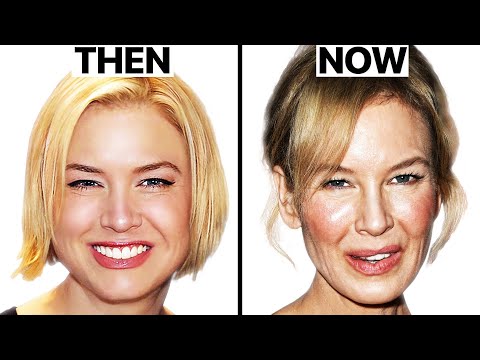 Renee Zellweger: Why She Looks So Different | Plastic Surgery Analysis