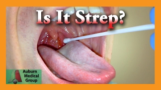 Is it Strep Throat? | Auburn Medical Group