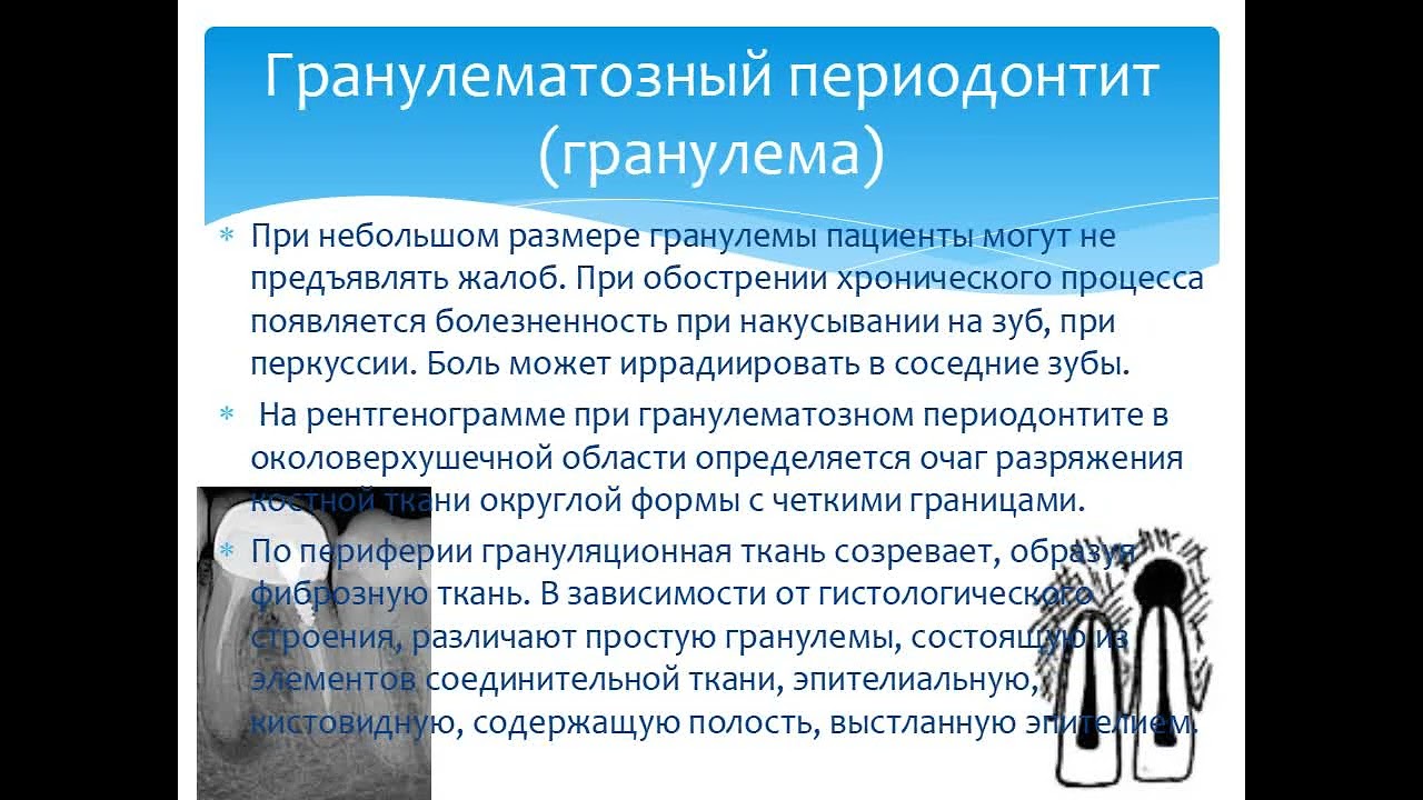 Хронические формы периодонтитов