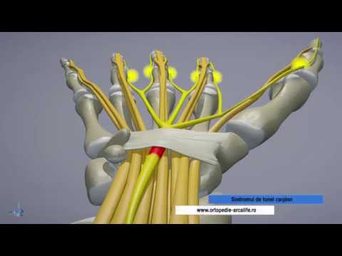 reparația articulației pumnului