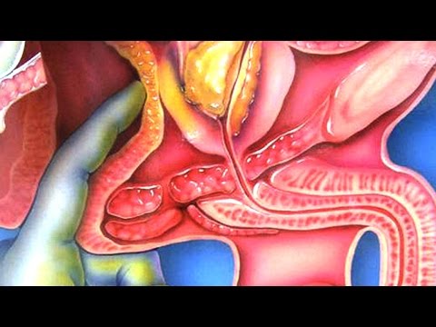 Injektionen für die Wirksamkeit der Prostata BPH Urin nicht abgehen