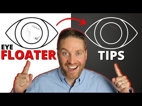 Eye Floaters Help! - 5 Natural Life Hack Remedies For Adapting To Eye Floaters