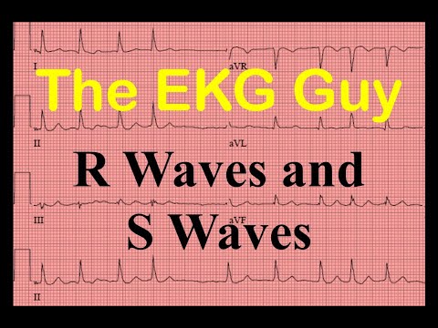 EKG/ECG R Waves and S Waves - Question 7.0 | The EKG Guy