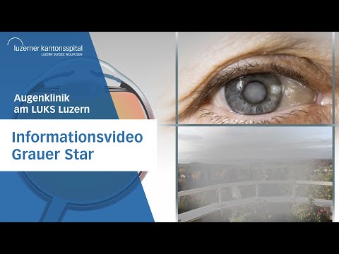Informationsvideo Grauer Star - Augenklinik Luzerner Kantonsspital