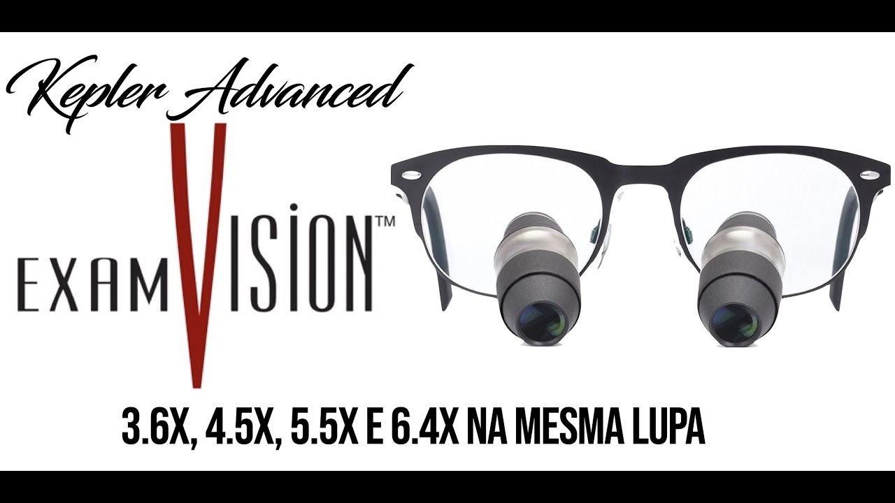 Lupa Kepler Advanced da ExamVision - Vale a Pena?