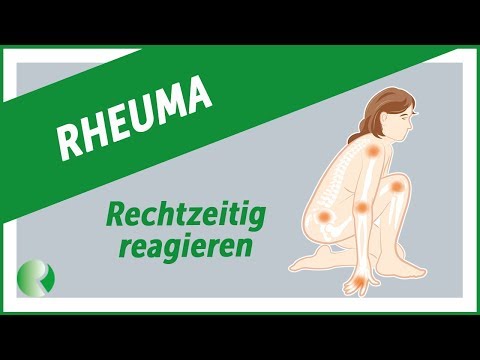 Flex gemeinsame Bewertungen Glaukom und Osteochondrose