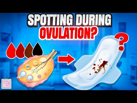 What causes ovulation problems