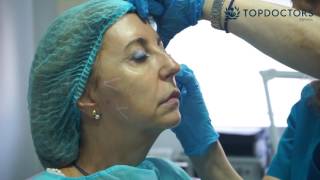 Lifting sin cirugía - Técnicas existentes