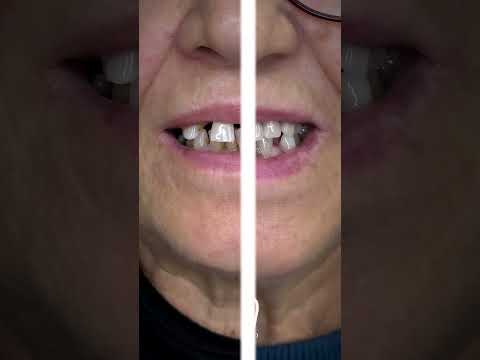 Maria Patrizia Di Caprio-27