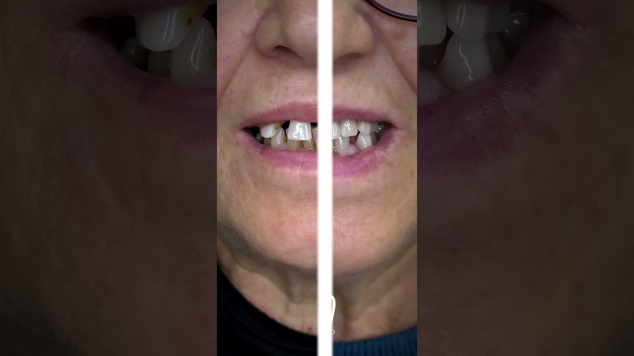 Maria Patrizia Di Caprio-27