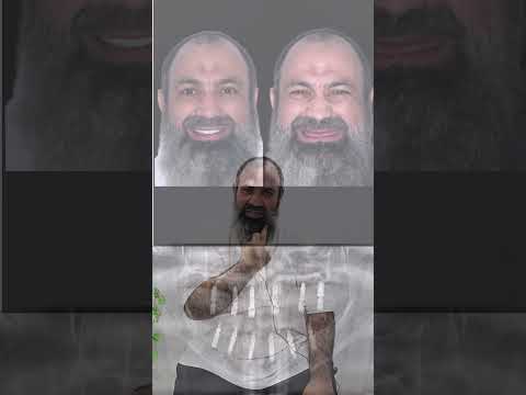 سعودية – زراعة فكين
