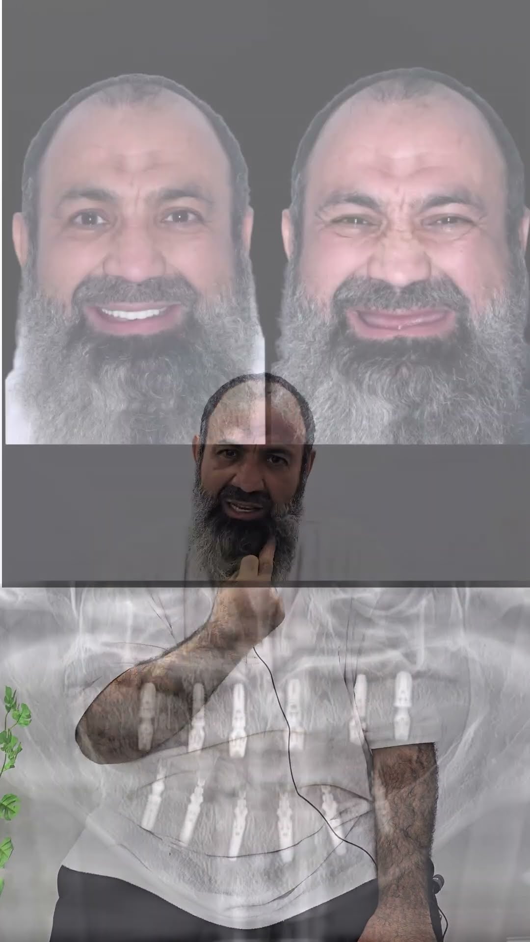 سعودية – زراعة فكين