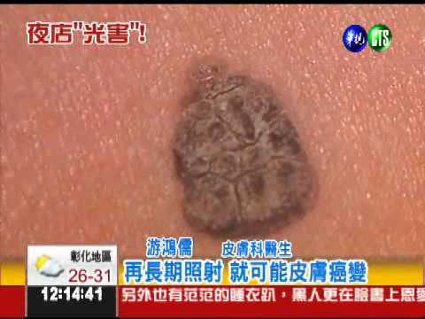 夜店探照燈光害 當心恐成"包公臉"!