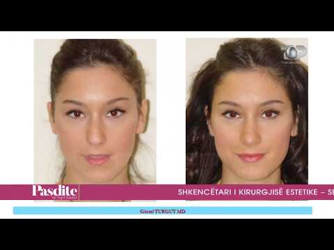 Pasdite ne TCH, Liv Hospital sekretet e kirurgjisë estetike, 18 Tetor 2017, Pjesa 4