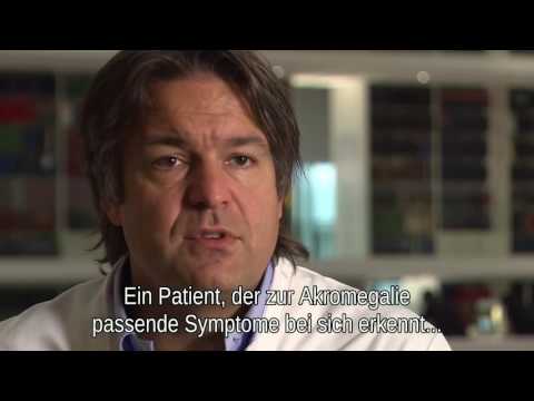 Doktor Sebastian Neggers: seltene erkrankung Akromegalie