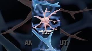 Download lagu Five people no longer need their lupus medication thanks to a novel treatment mp3