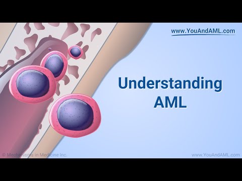 Zrozumienie ostrej białaczki szpikowej (AML)